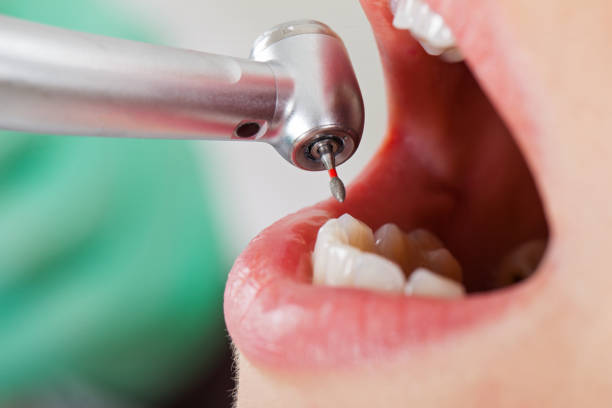 Best Root Canal Emergency Dentist  in Hinesville, GA